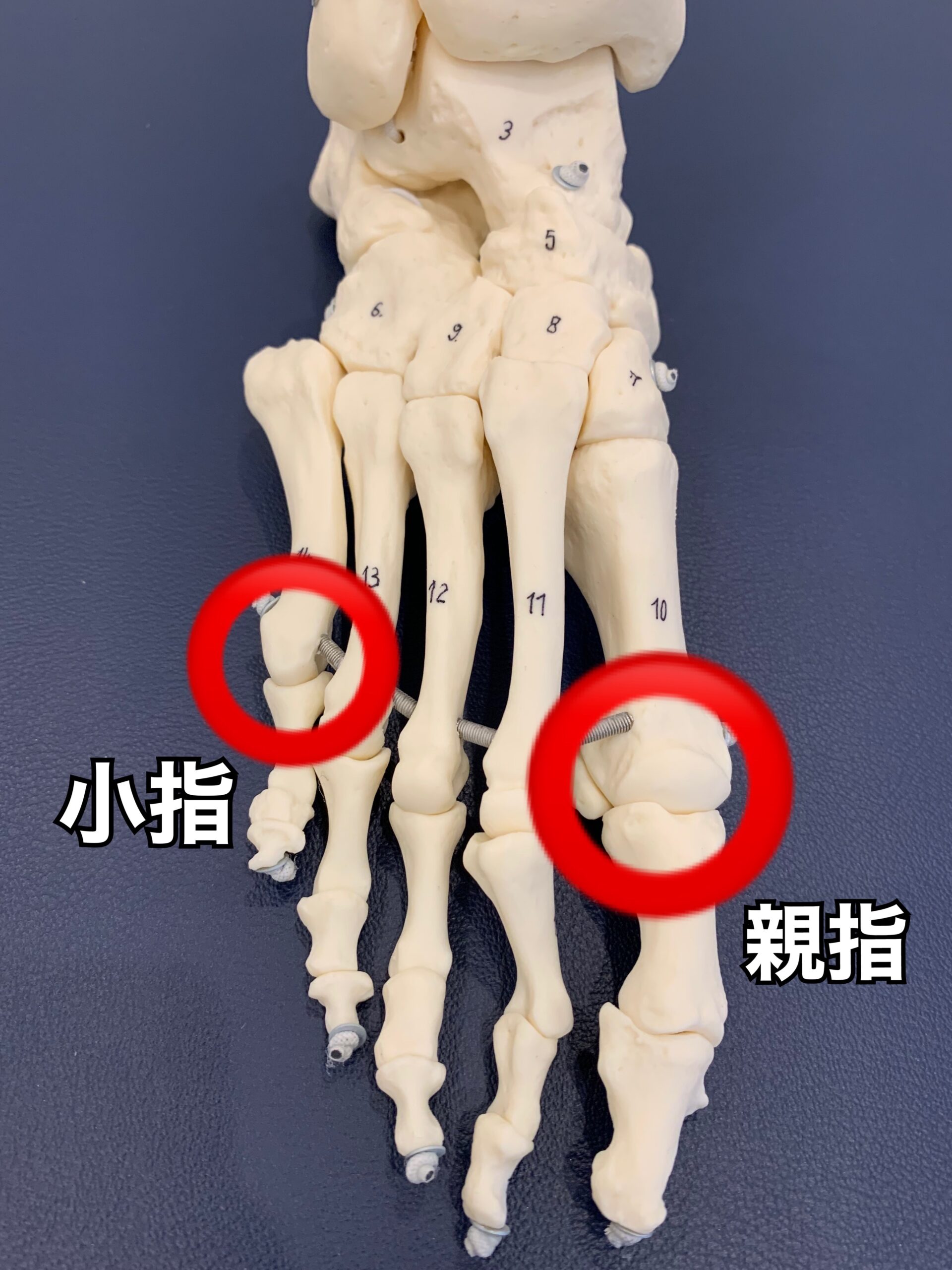 右足小指の外側の痛み。根本的に解消する正しい歩き方とは - ユーカリ整体院